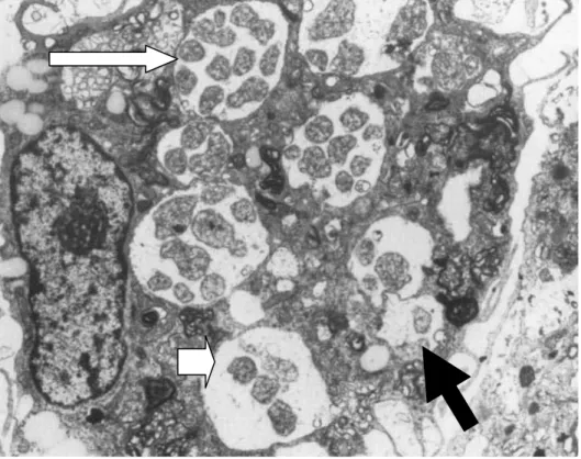 Figura 1- E.canis no citoplasma de um monócito, fotografia de microscópio electrónico
