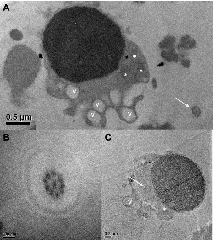 Figura  2.  A-  Vista  interna  do  espermatozoide  de  jundiá  amazônico  (Leiarius  marmoratus)  e  detalhes  da  peça  intermediária