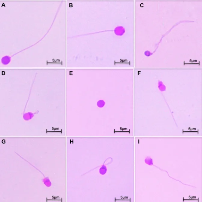 Figura  3.  Principais  anormalidades  morfológicas  observadas  no  sêmen  do  jundiá  amazônico  pós-descongelamento:  A-  espermatozoide  normal;  B-  macrocefalia;   C-microcefalia e cauda degenerada; D- cauda fortemente enrolada; E- cabeça isolada; 