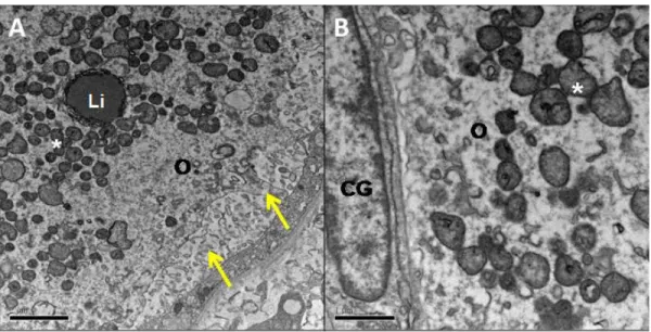 Figura  10.  Imagens  de  microscopia  eletrônica  de  transmissão  de  folículos  pré-antrais  em  tecido  ovariano  criopreservado com DMSO
