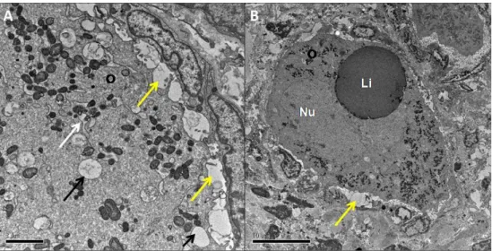 Figura  11.  Imagens  de  microscopia  eletrônica  de  transmissão  de  folículos  pré-antrais  em  tecido  ovariano  criopreservado  com  EG
