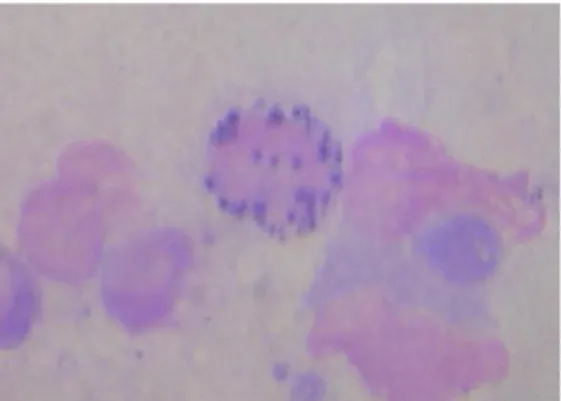 Figura  20:  Formas  amastigotas  de  Leishmania  infantum  num  nódulo  de  um  canídeo