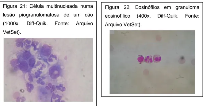 Figura  22:  Eosinófilos  em  granuloma  eosinofílico  (400x,  Diff-Quik.  Fonte: 