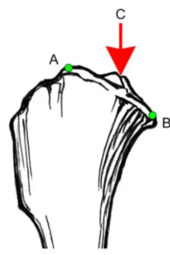 Figura 10. Aspeto medial proximal da tíbia. Extensões cranial (ponto A, imediatamente caudal ao  ponto  de  inserção  do  LCCr)  e  caudal  (ponto  B)  do  côndilo  tibial  medial:  pontos  de  referência  para  traçar  a  linha  do  plateau  tibial  no  p