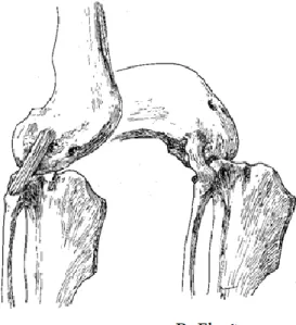 Figura 5 – Ligamento colateral lateral tenso em extensão e relaxado em flexão  (Adaptado de Vasseur, 2003) 