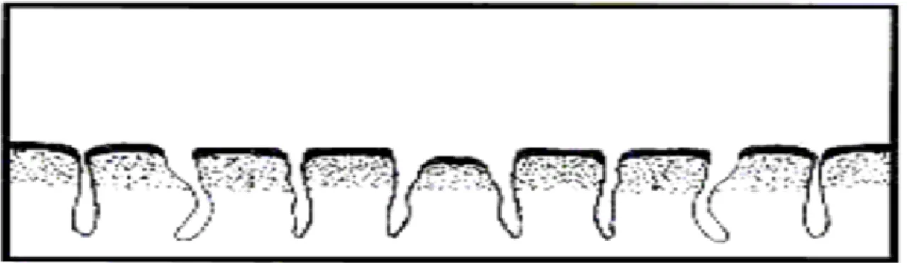 Figura 2 – Mucosa do intestino delgado com as vilosidades atrofiadas