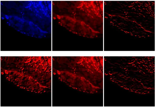 Figure 2.3: Different 3x3 kernels applied to the raw image. From left to right: Top - Raw Image, [[-0.0625, 0.125, 0.0625],[0.125, 0.25, 0.125],[0.0625, 0.125, 0.0625]],[[-1,2,1],[0,0,0],[1,2,1]];  Bottom:[[-2,-1,0],[-1,1,1],[0,1,2]],[[0,-1,0],[-1,5,-1],[0