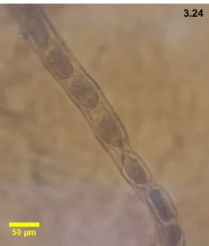 Figura  3.24  –  Fotomicrografia  de  E.  gastricus,  mostrando  a  porção  média  da  fêmea  com  o  útero  preenchido por uma fiada de ovos