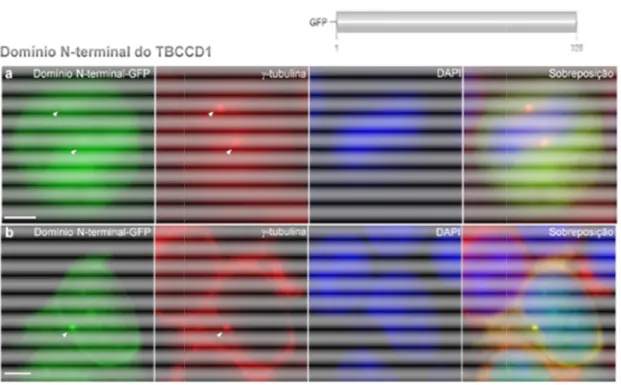 Figura I.11:  O N-terminal da proteína TBCCD1 determina a sua localização centrossomal.