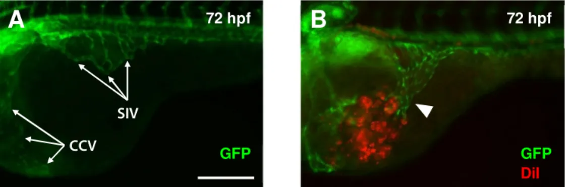 Figura 4: Modelo de xenotransplante tumoral em embrião de peixe-zebra (A) Embrião de peixe-zebra  transgénico  Tg(fli:EGFP)  (indicadas  com  setas  brancas  no  topo  da  imagem  estão  as  veias   sub-instestinais (SIV) e no lado esquerdo as veias comuns