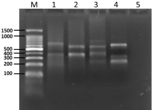 Figura 12 – Análise da amplificação por PCR de DNA extraído com proteinase K. 
