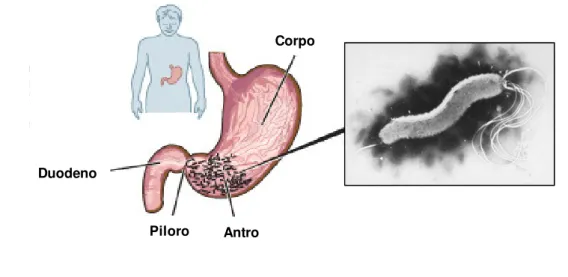 Figura  1:  Anatomia  do  estômago  do  Homem  e  a  localização  de  Helicobacter pylori (Adaptado de http://www.helico.com/)