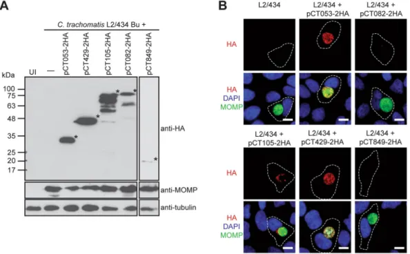 Figure 1.  The chlamydial candidate T3S effector CT105 is delivered by C. trachomatis into the cytoplasm of  infected cells