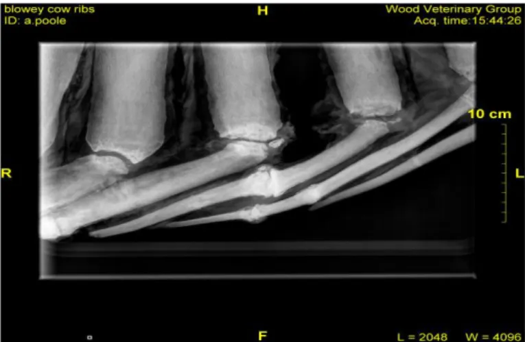 Figura  2  -  Radiografia  torácica  de  vaca  com  lesões  costais.  Projecção  látero- látero-lateral esquerda com fractura de costelas (Blowey, 2011).