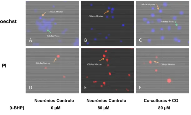 Figura  3  –  Imagem  representativa  das  contagens  efectuadas  em  culturas  primárias  de  neurónios  de  cerebelo  após  da  indução  de  morte  por  stress