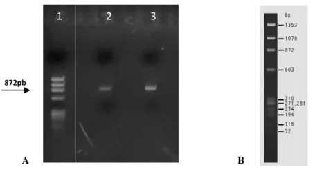 Figura 4.2 – A) Gele de agarose a 0.7% com 1,5  coloração  com  brometo  de  etídio. 