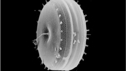 Figure 4. Diatom. Division chrysophyta, 15 microns, Monterey Bay Aquarium  [15]