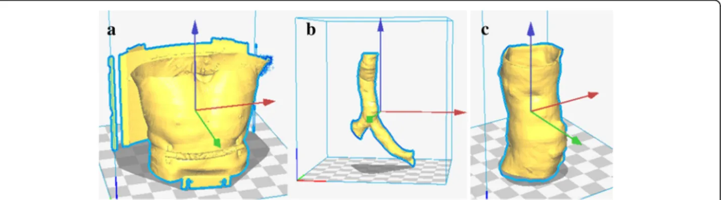 Fig. 2 3D models in .stl format based on the patient ’ s CT scan: a initial model received; b model after some modifications; c model ready to print