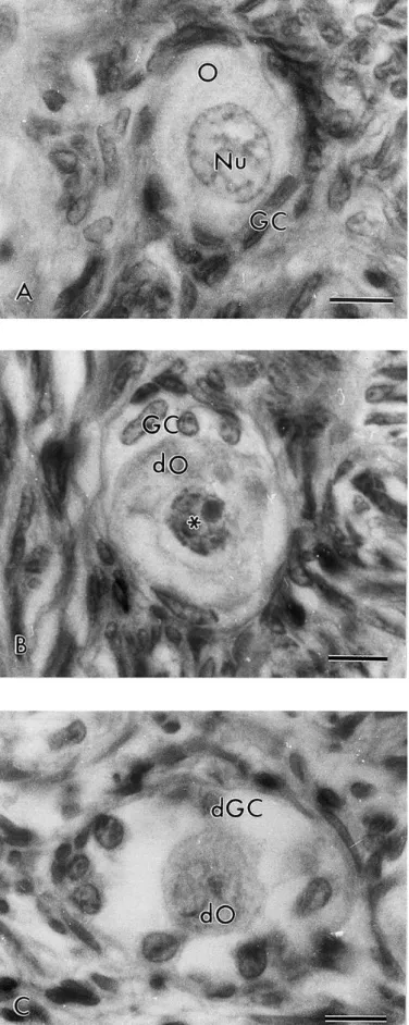 Fig.  1.  Histological  section  of  ovarian  fragment  after  staining  with  Periodic  Acid  Shiff-hematoxylin,  showing (a) normal preantral follicles; (b) Type 1 degenerated follicles; (c) Type 2 degenerated follicles