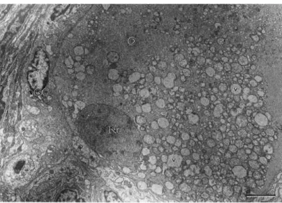 Fig. 2. Electron micrograph of a normal preantral follicle. O: oocyte; Nu: oocyte nucleus; GC: granulosa  cells; m: mitochondria; ser: smooth endoplasmic reticulum; bars=2 μm