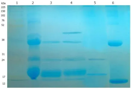 Figure  11:  Electrophoresis  of  Mauritia  flexuosa  lectins:  The  crude  extract  showed  3  bands,  extract  with  chitin  binding  lectins showed  4  bands,  and  extract  with  lectin ligands  of chitin after  autoclaving showed  2  bands