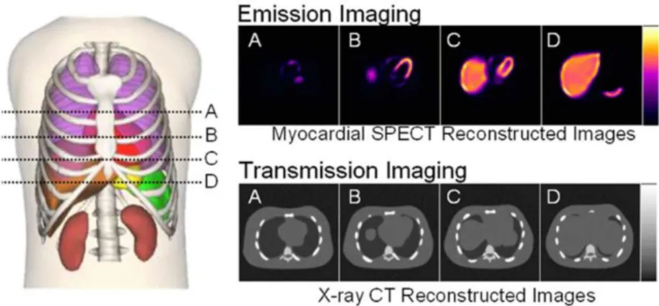 Fig. 2.15. Anterior view of the 4-D NCAT combined with models of imaging process, the phantom can simulate emission  and transmission imaging data 47 
