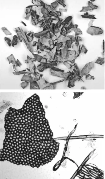 Fig. 2. Birch (Betula pendula Roth.) bark. (a) Granulometric fraction with >2 mm particles, observed under the magnifying glass; (b) microscopic observations of dissociated cells obtained from the 0.180 to 0.250 mm granulometric fraction.