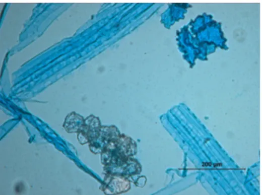 Figure 3. Microscopic observations of dissociated cells obtained from the &lt;0,180 mm granulometric  fraction after fractioning of Pinus pinea bark.