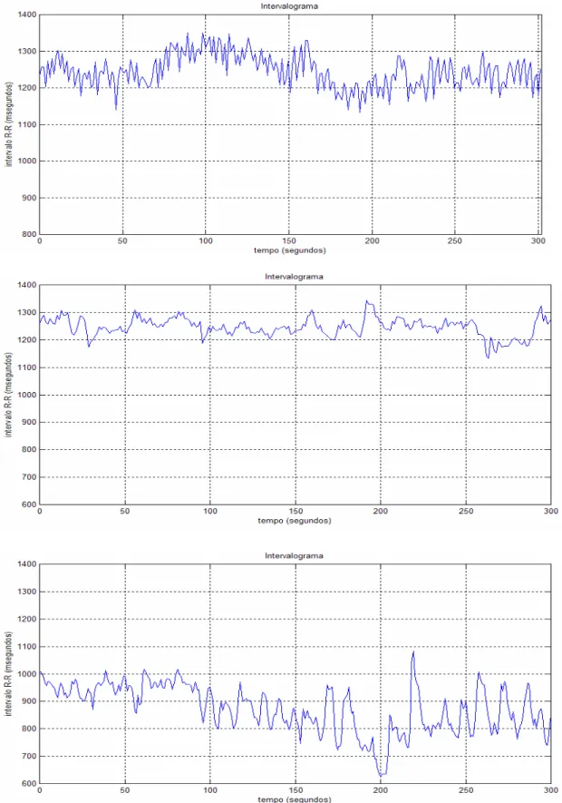 FIGURA  4:  Exemplos  representativos  dos  períodogramas  de  5  minutos  de  registro  dos intervalos R-R obtidas em 3 voluntários na mesma situação funcional, por meio  do eletrocardiograma digital e processadas pelo software ECGLAB 