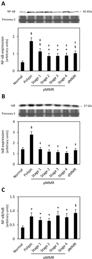 Fig. 2.NF- κκκκ B and I κκκκ B protein levels and NF- κκκκ B/I κκκκ B ratio in human colon cancer.(A) NF- κ B and (B) I κ B  steady-state  levels,  and  (C)  NF- κ B/I κ B  ratiosin  normal  colon  samples,  polyps,  stages  1-4  pMMR,  and  dMMR tumors