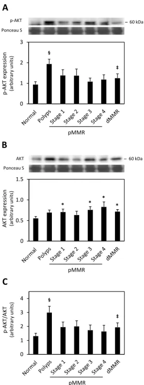 Fig. 3.p-AKT and AKT protein levels, and p-AKT/AKT ratio in human colon cancer.(A) p-AKT and (B) AKT  steady-state  levels,  and  (C)  p-AKT/AKT  ratioin  normal  colon  samples,  polyps,  stages  1-4  pMMR,  and  dMMR tumors.Total proteins were extracted 