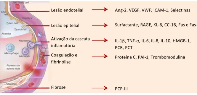 Tabela 2. Marcadores bioquímicos de prognóstico em ARDS 