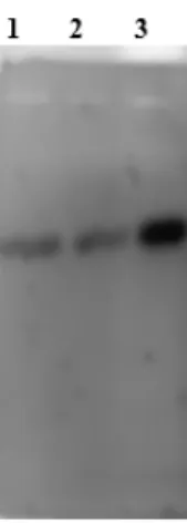 FIGURA 3 Imagem  do  gel  de  eletroforese  mostrando  o  produto  da amplificação de PCR realizada pelo sistema multiplex, contendo os cinco loci genéticos em uma única reação