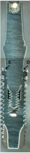 Figura 1. Conjunto implante/pilar protético seccionado para análise no MEV (E-lado esquerdo e D-lado  direito da amostra); (1) região superior esquerdo; (2) região média esquerda; (3) região inferior esquerda; 