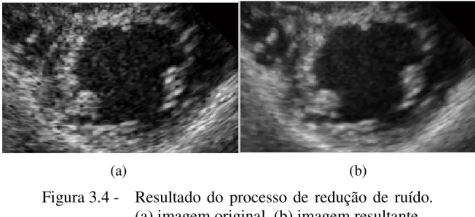 Figura 3.4 -  Resultado  do  processo  de  redução  de  ruído. 