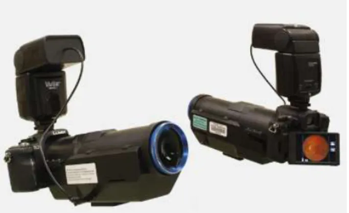 Figure 3.2: Hand-held, low cost fundus camera prototype developed in [26].