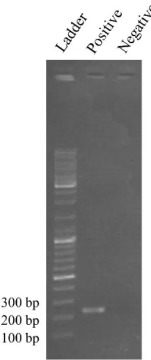 Figure 3.1: Electrophoretic analysis of the PCR-amplified extraction product, including positive and negative  controls, in comparison with a DNA ladder