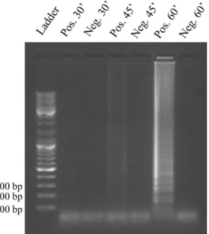 Table 3.1: Summary of the results obtained for the study of the LAMP reaction time. “Y” indicates that there  was DNA amplification and “N” indicates that there was no amplification