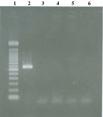 Figura 1 - Eletroforese em gel de agarose 2% de 10|iL de  produto de PCR na amplificação de fragmento do  gene SSrRNA de B