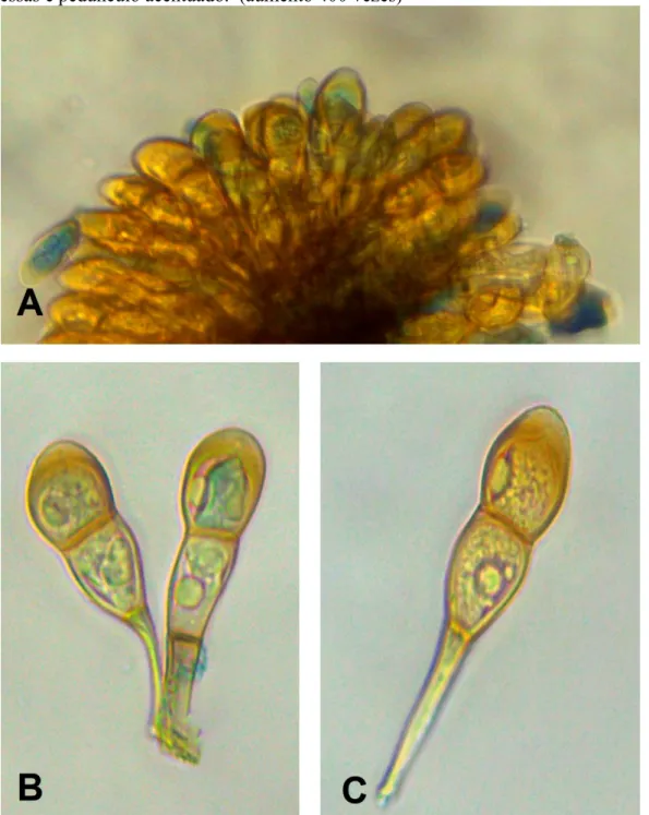 Figura 2- A) Télia contendo teilósporos de Puccinia sp. em Emilia fosbergii. B) Dois teliós- teliós-poros mostrando discreta variação morfológica