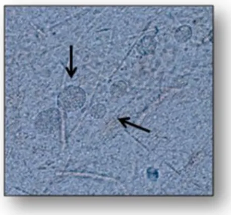 Figure   1.1.  T.  gondii  tissue  cysts  with  multiple bradyzoite  enclosed  in  mouse  brain  cells