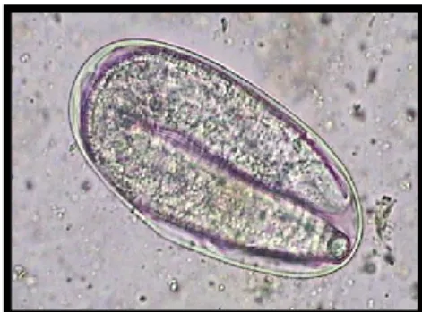 Figura 16- Ovo de Strongyloide westeri com larva no seu interior.  