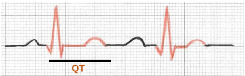 Figura 9. Representação do intervalo QT (vermelho) num ECG. 