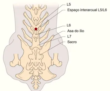 Figura 8 – Determinação do local de inserção da agulha para a colheita de LCR  na região  lombar,  com  representação  dos  pontos  de  referência  anatómicos  para  cães  pequenos  (adaptado de Wood et al., 2012).