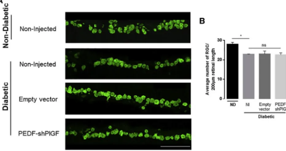 Figure 6. Retinal Ganglion Cells’ Density in Retinal Sections of Non-diabetic or Diabetic Mice, 21 Days after Subretinal Injection of Empty Vector or  pPEDF-shPlGF