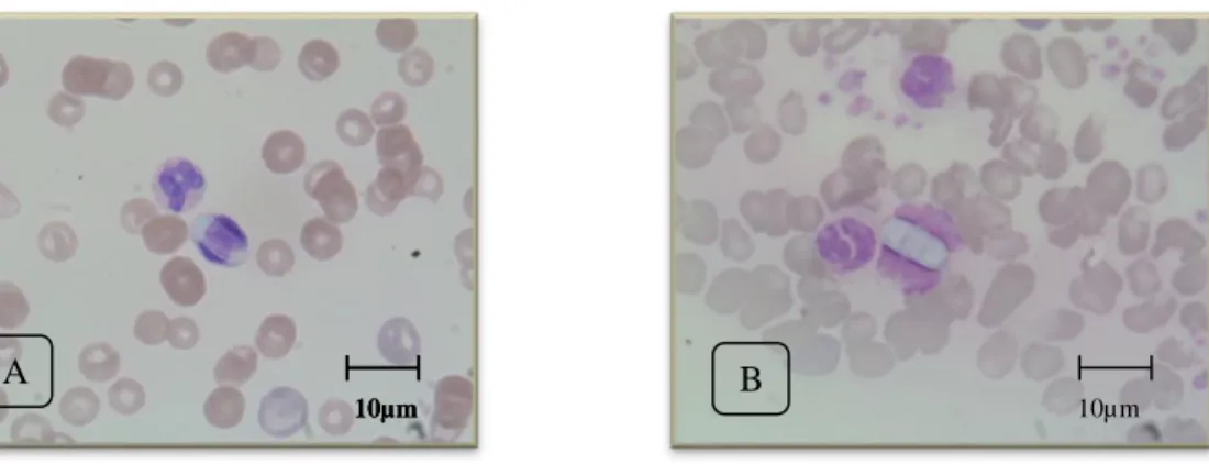 Figura 4: Hepatozoon canis em neutrófilos. A- amostra nº38. B- amostra nº58. (Originais)