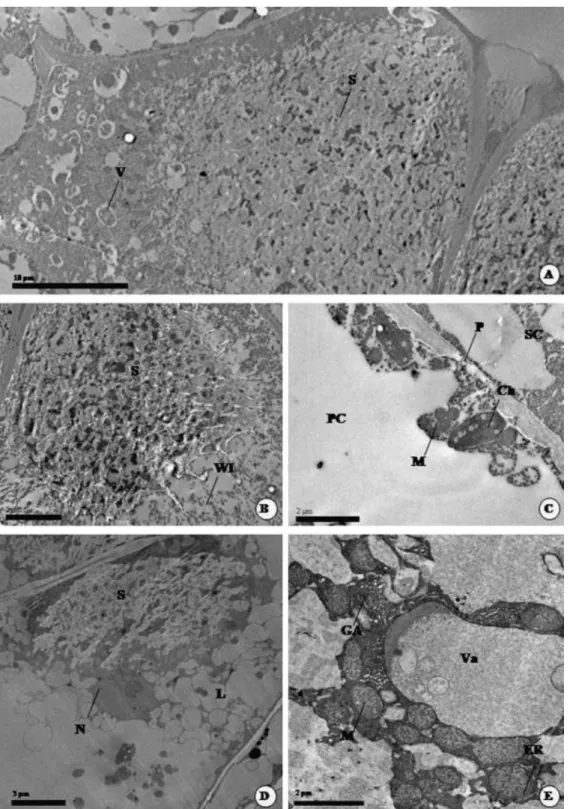 Fig. 3. Transmission electron microscope images (TEM) of  nectar secretory structures in Calolisianthus  leaves