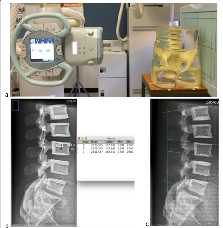 Fig. 1 a Equipment setting for image acquisition. b Reference image acquired with baseline protocol and with contrast-to-noise ratio measurement using ImageJ software