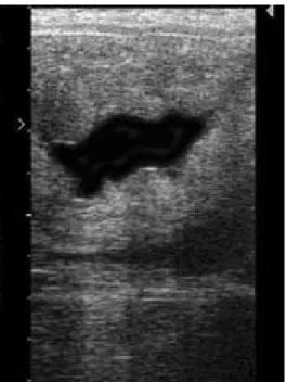 Figura 4 – Imagem ecográfica de endometrite 
