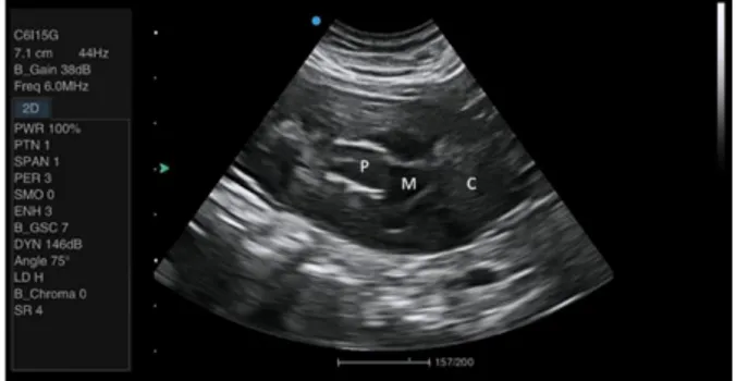 Figura 3. Imagem ultrassonográfica de exame transabdominal  do rim direito de caprino Canindé de quatro anos de  idade